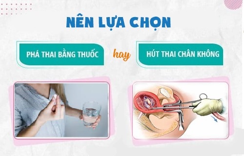 Phá thai an toàn ở hà nội bao nhiêu tiền