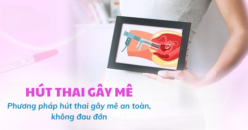 Phương pháp hút thai gây mê giảm đau đớn, không nguy hiểm 