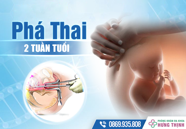 Những điều cần biết về cách phá thai 2 tuần tuổi an toàn 