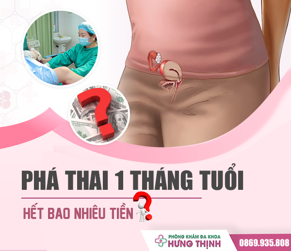 Phá thai 1 tháng tuổi hết bao nhiêu tiền? Tư vấn và tham khảo bảng giá