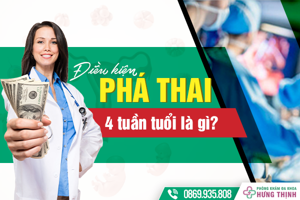 Chi phí phá thai 4 tuần tuổi hợp lý - Tìm hiểu địa chỉ phá thai an toàn, uy tín