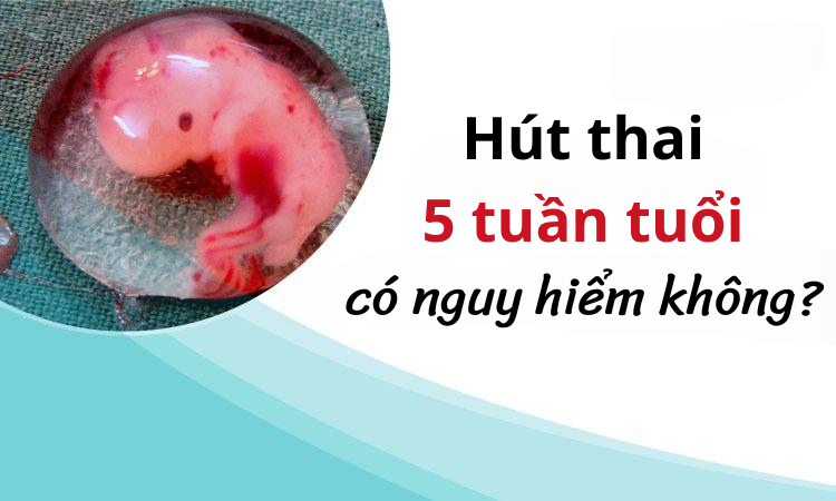 Hút thai 5 tuần tuổi có nguy hiểm không? - Chi phí hút thai 5 tuần tuổi 